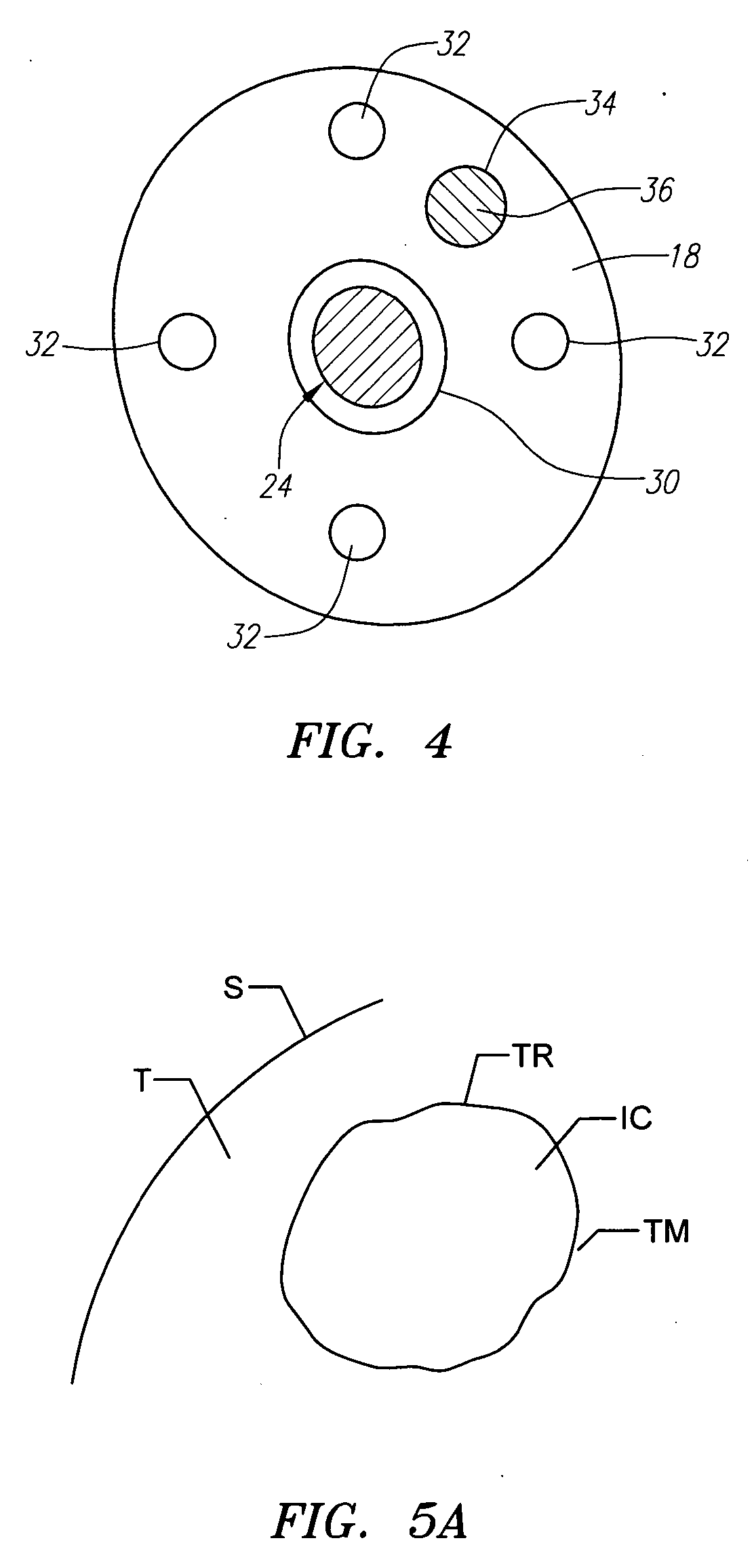 Apparatus and method for performing therapeutic tissue ablation and brachytherapy