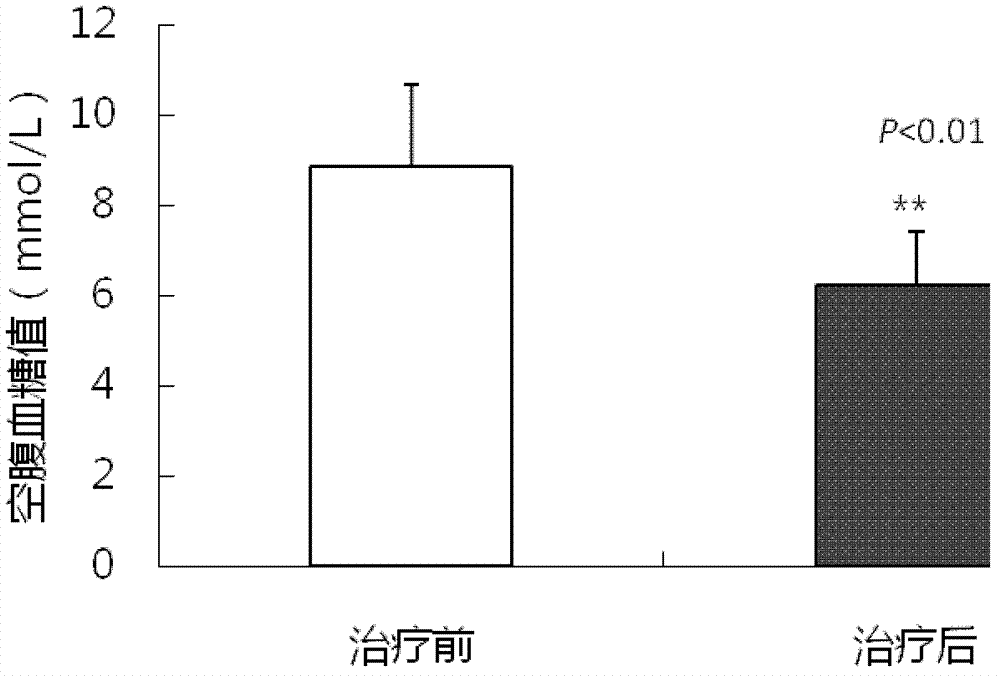 Natural medicine for treating 2 type diabetes, and preparation method thereof