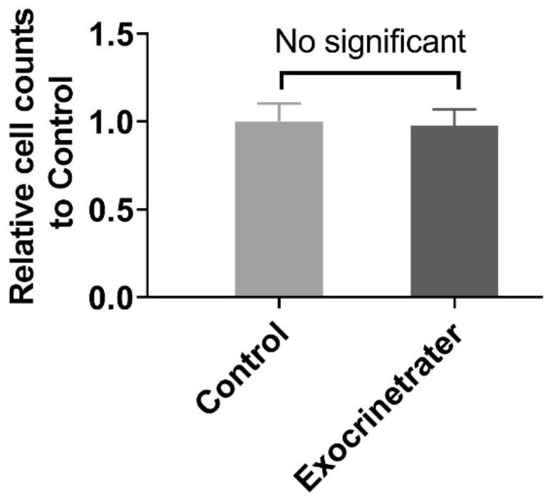 Preparation method and application of a kind of artificial exosome complex