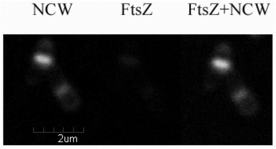 A kind of recombinant bacteria and its application