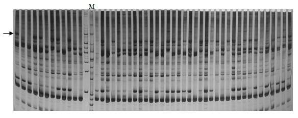 Molecular marker of content of soluble sugar in August red pear fruit