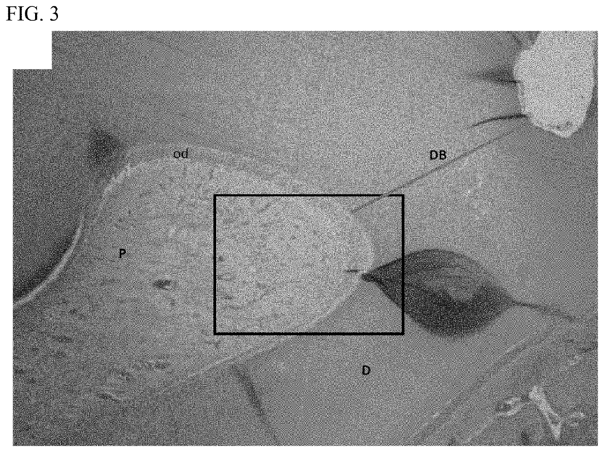 Tooth capping method with amelogenin