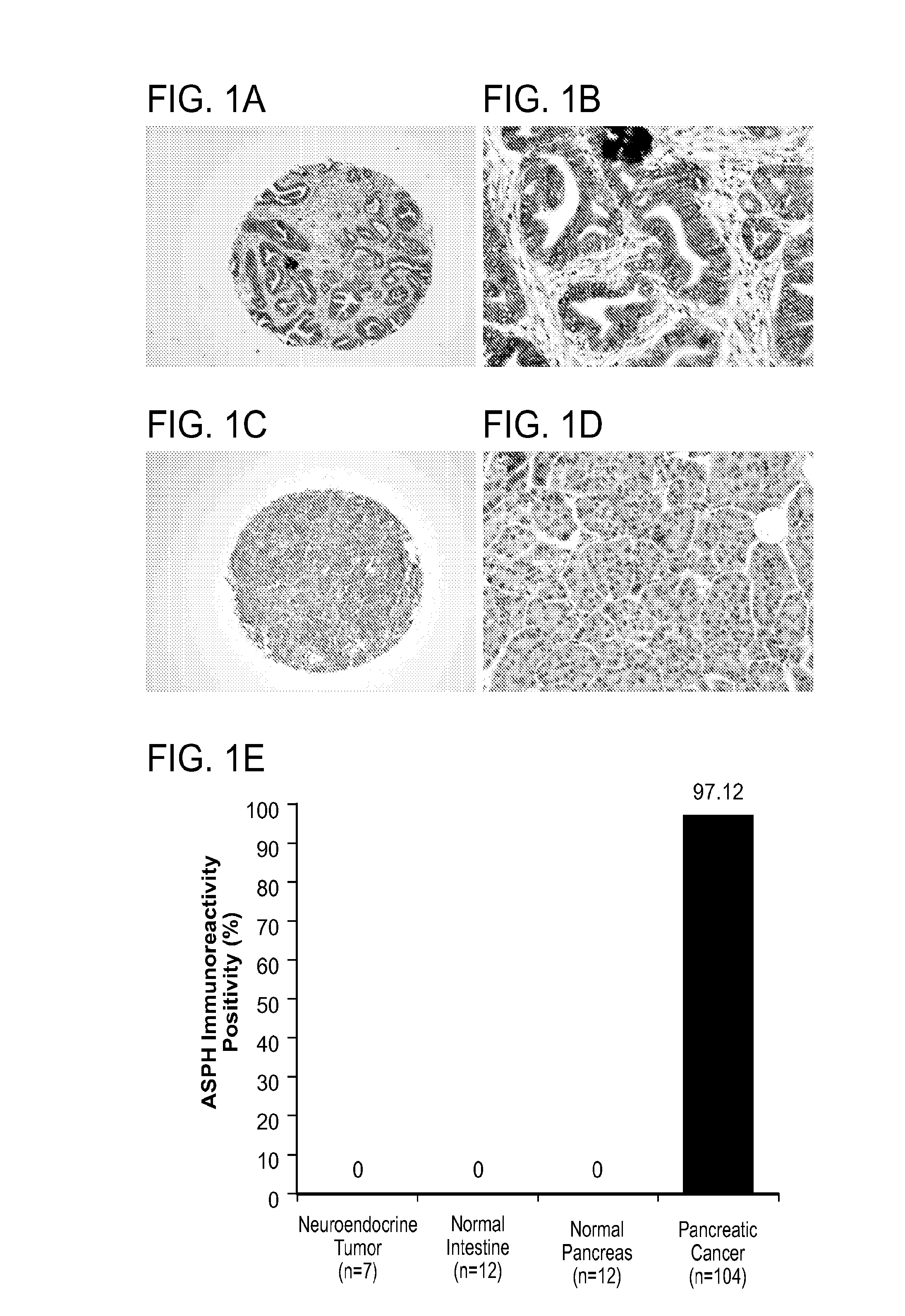 Inhibitors of Beta-Hydroxylase for Treatment of Cancer