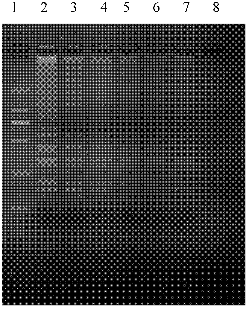 Real time-loop-mediated isothermal amplification (RT-LAMP) detection primers for performing differential diagnosis on canine distemper virus wild strains and vaccine strains and application of primers