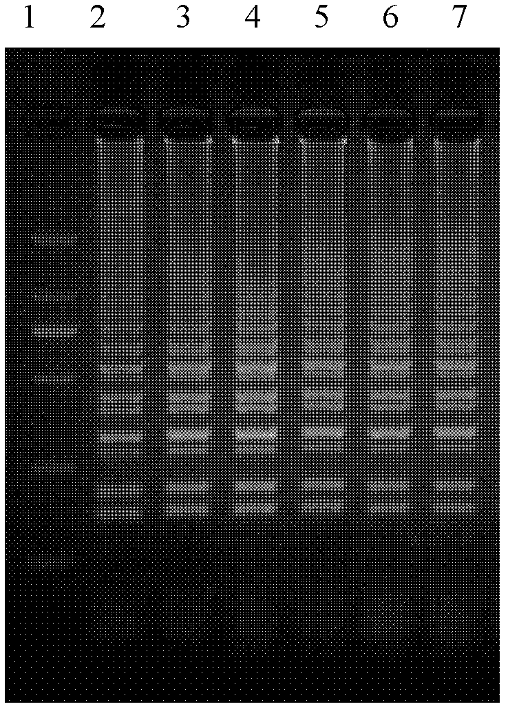 Real time-loop-mediated isothermal amplification (RT-LAMP) detection primers for performing differential diagnosis on canine distemper virus wild strains and vaccine strains and application of primers