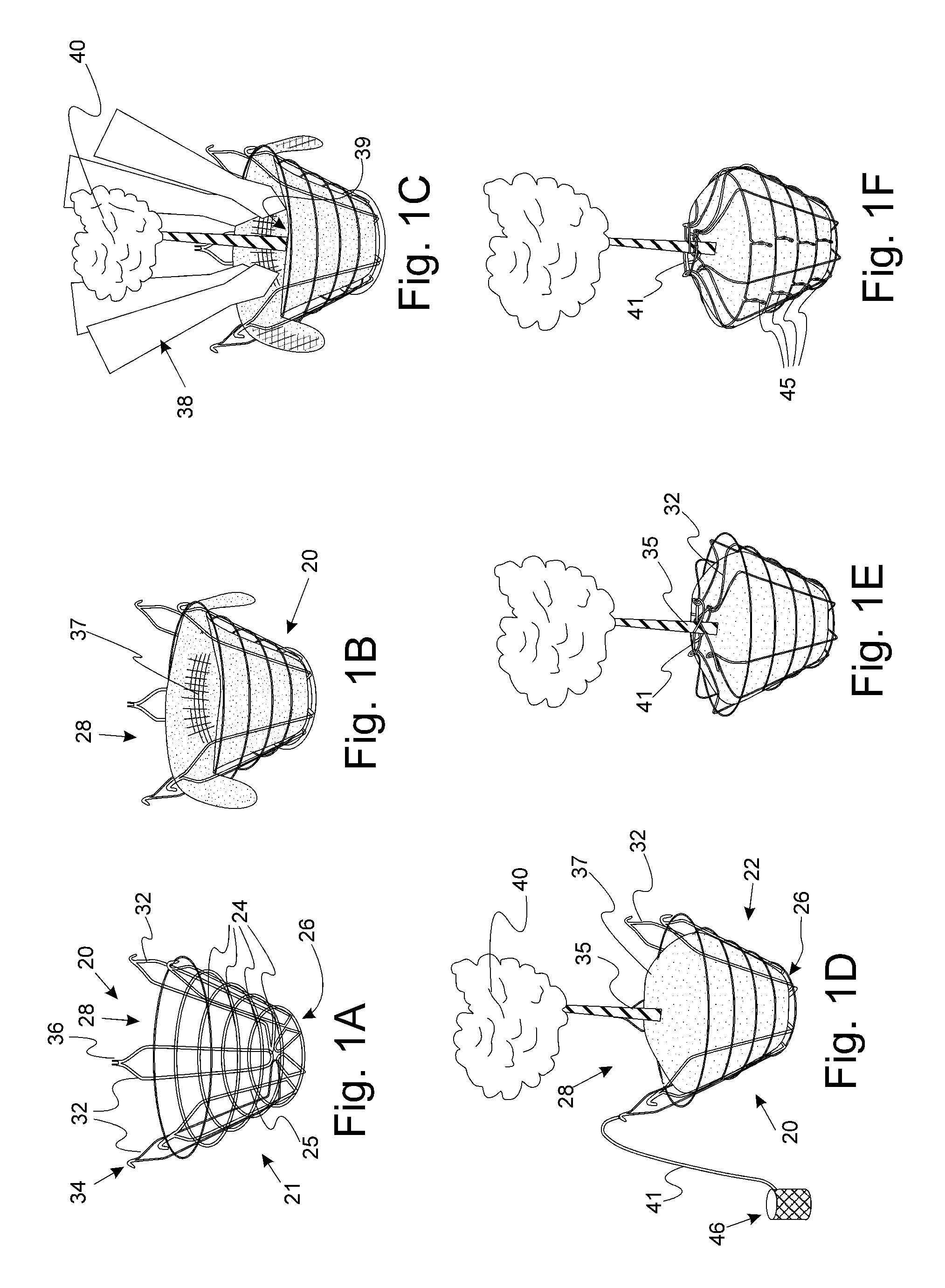 Tree Balling Method, System, and Wire Basket Used Therein
