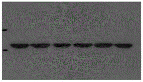 Mutated human zona pellucida protein 1, mutant gene, detection methods and applications thereof