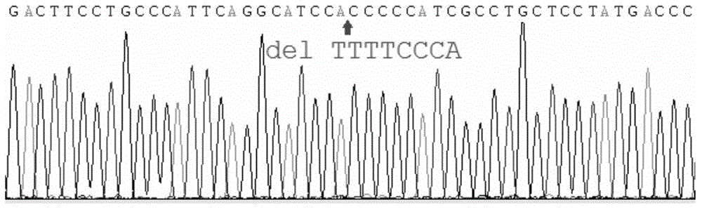 Mutated human zona pellucida protein 1, mutant gene, detection methods and applications thereof