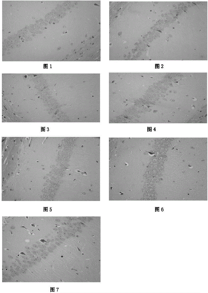 Application of acteoside to preparation of drugs for preventing nerve cell injuries caused by neurotrophic factors (NTFs) and receptors thereof