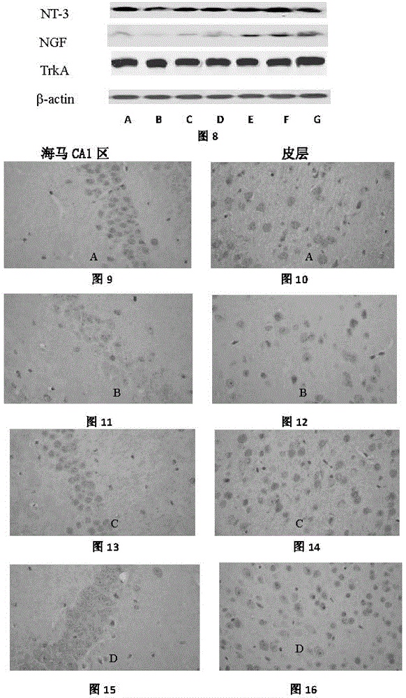 Application of acteoside to preparation of drugs for preventing nerve cell injuries caused by neurotrophic factors (NTFs) and receptors thereof