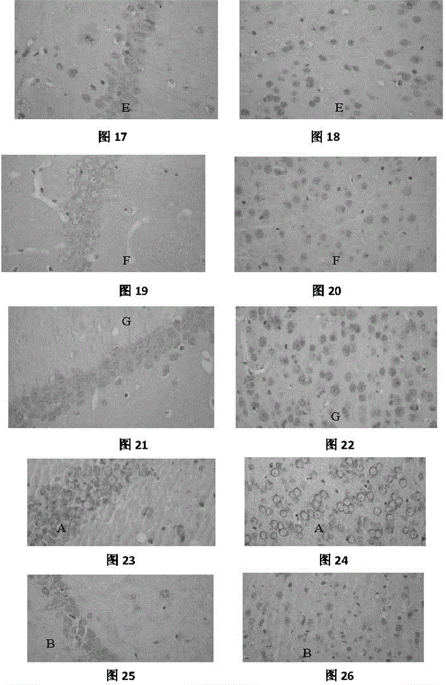 Application of acteoside to preparation of drugs for preventing nerve cell injuries caused by neurotrophic factors (NTFs) and receptors thereof