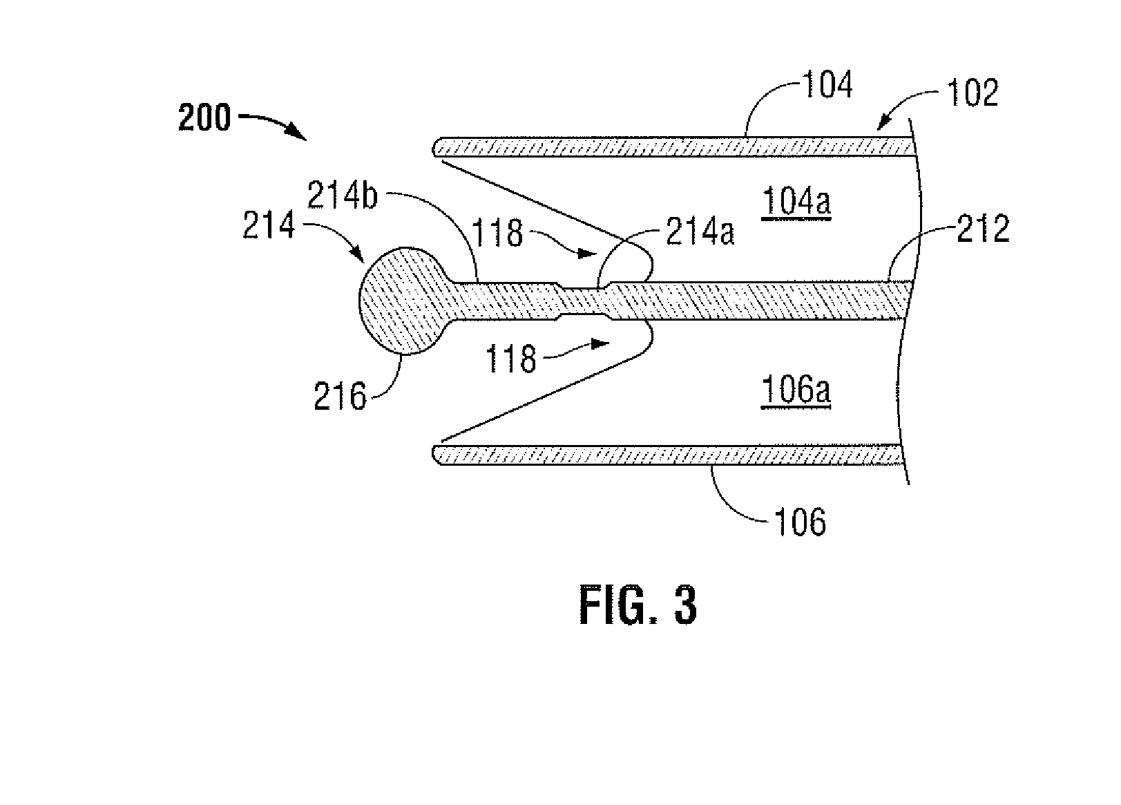 Catheter with articulable septum extension