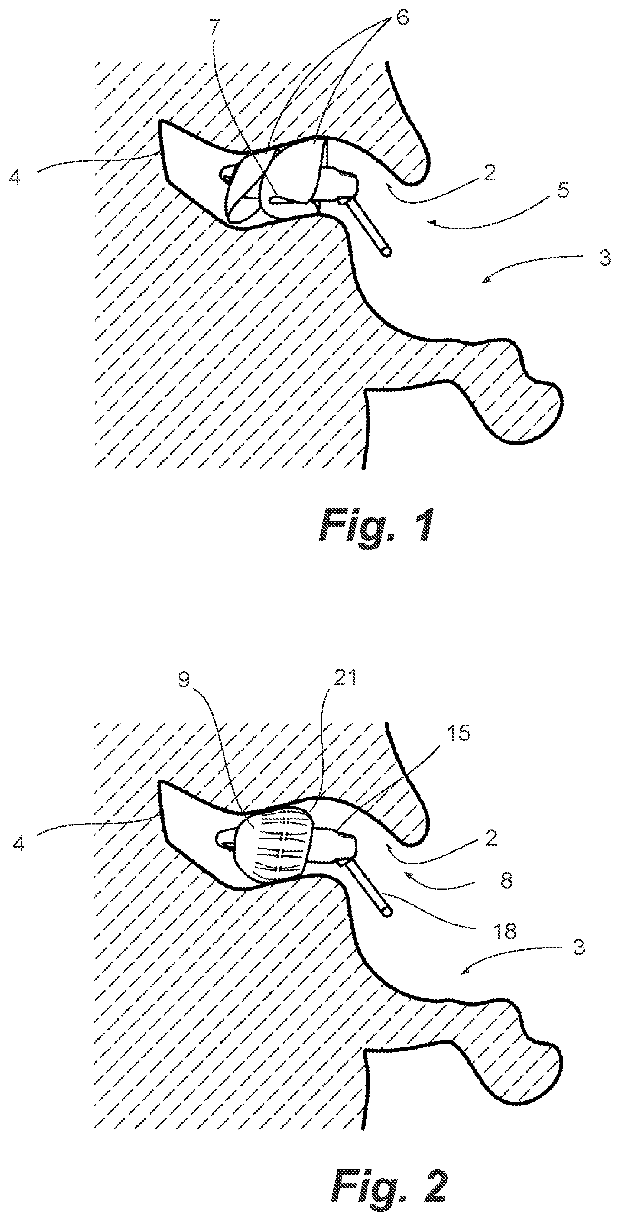 Flexible ear tip for a hearing aid