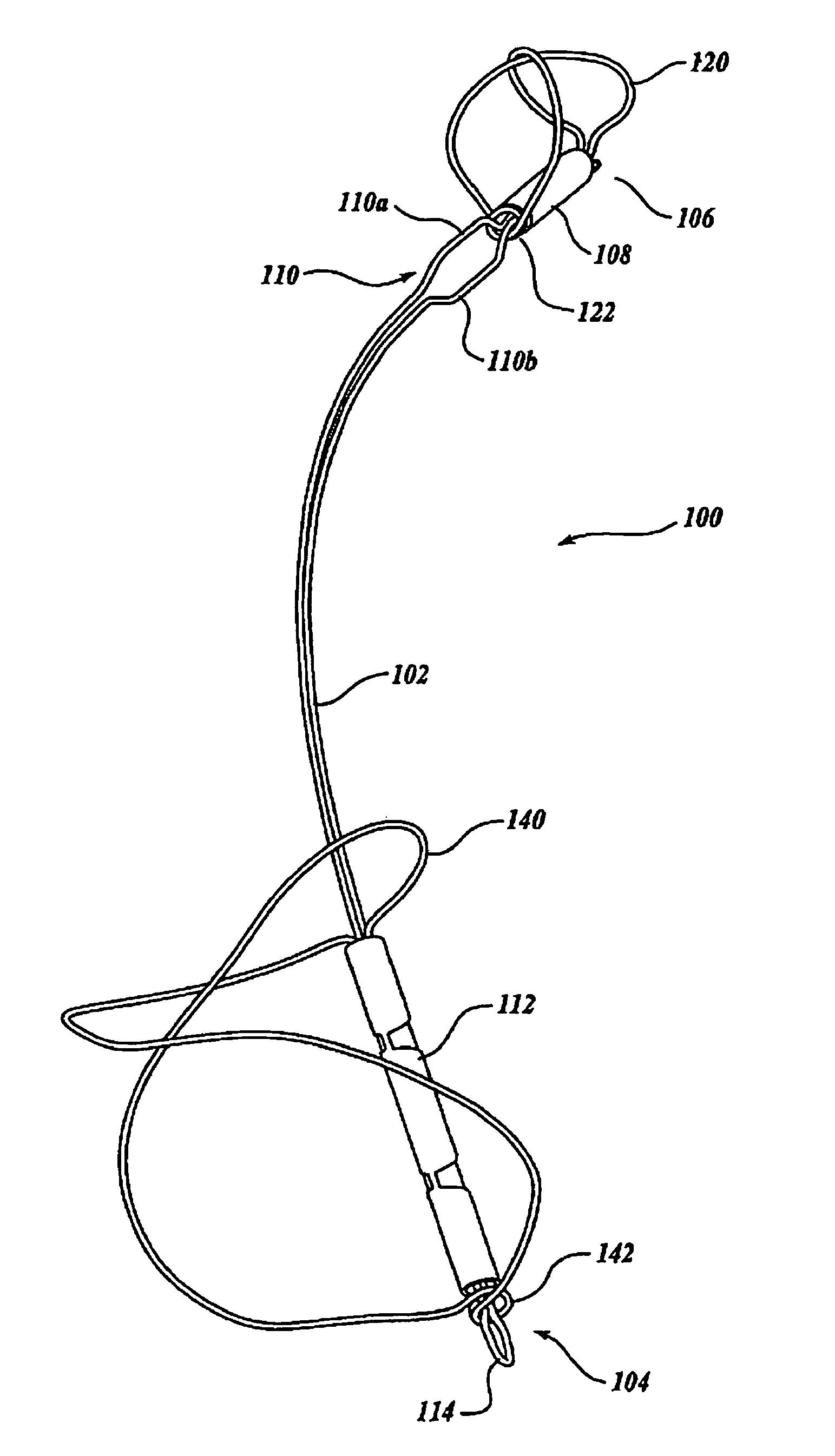 Device and method for modifying the shape of a body organ