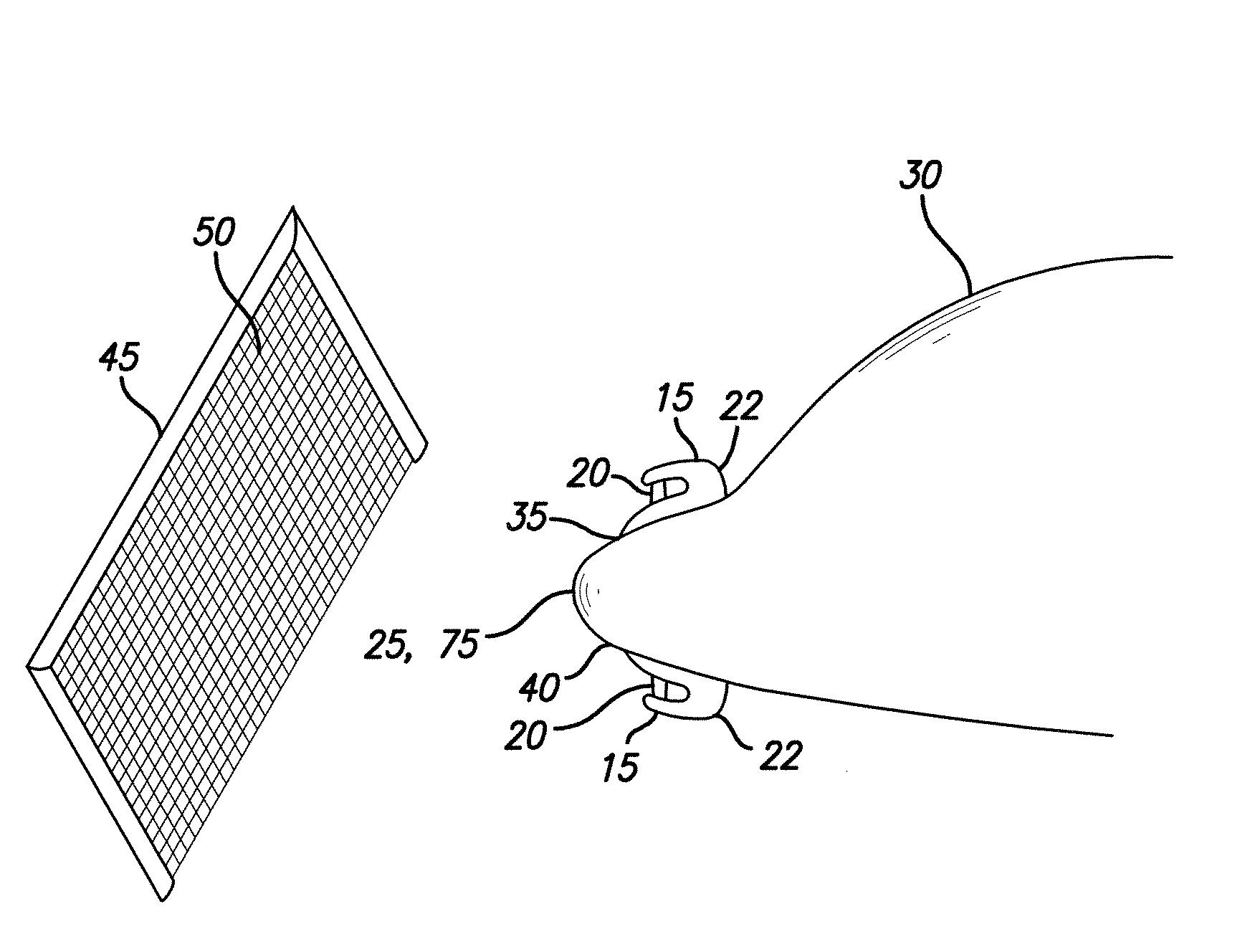 Method and device for retrieving aircraft