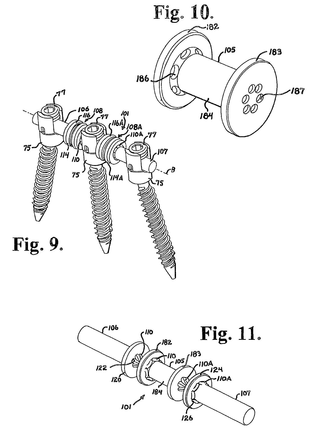Soft stabilization assemblies with pretensioned cords