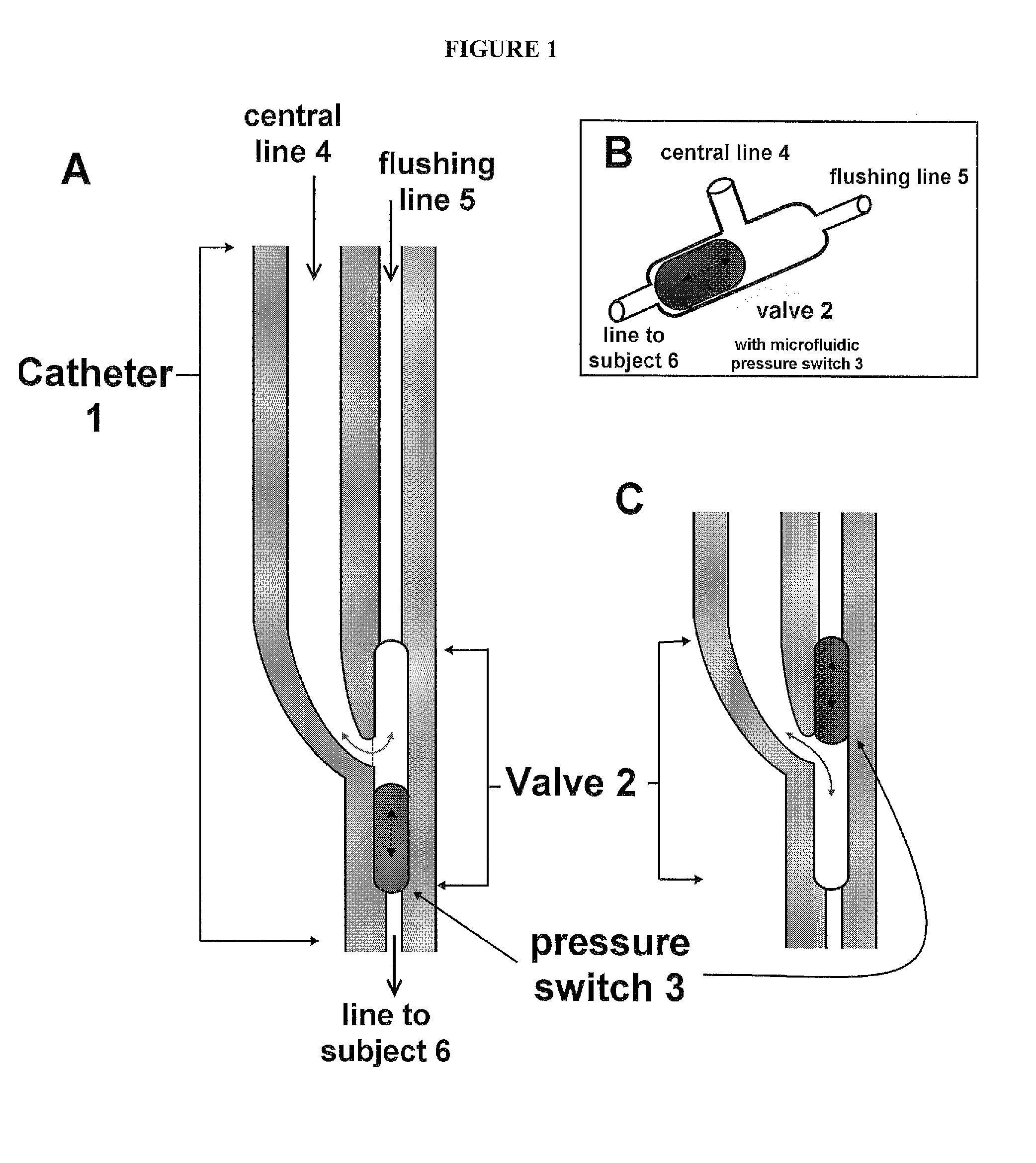 Flushable catheter affixed to a wash line activated by a microfluidic pressure switch