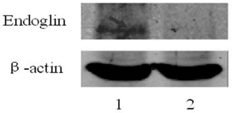 Heterologous fusion gene modified cancer cell/dendritic cell fusion tumor vaccine and preparation method thereof