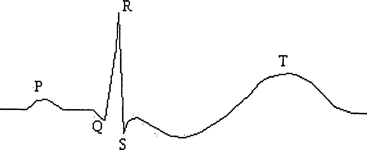 Alternating T-wave measuring method for sports electrocardiogram