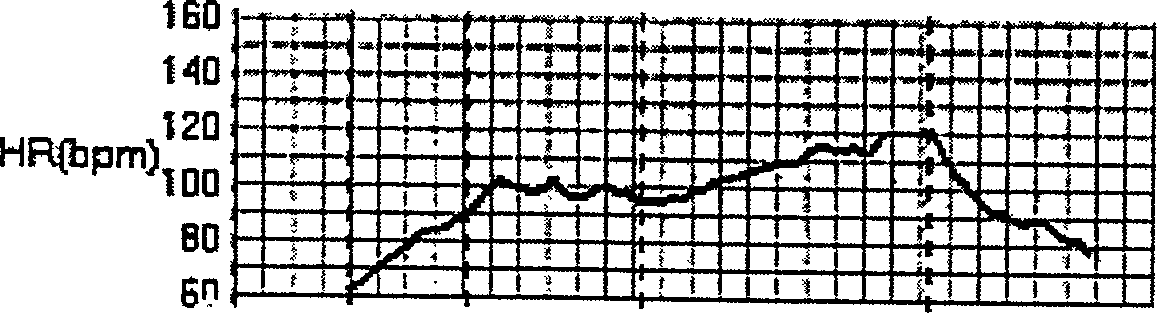 Alternating T-wave measuring method for sports electrocardiogram