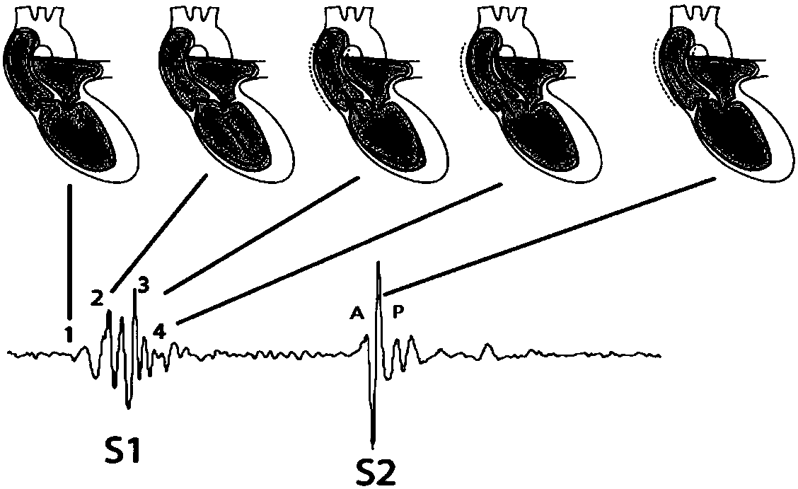 Method for acquiring heart sound signal source components