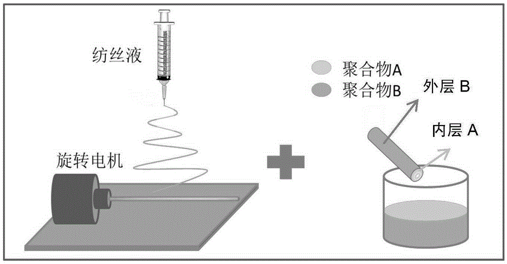 A kind of high-strength and high-elastic vascular stent and preparation method thereof