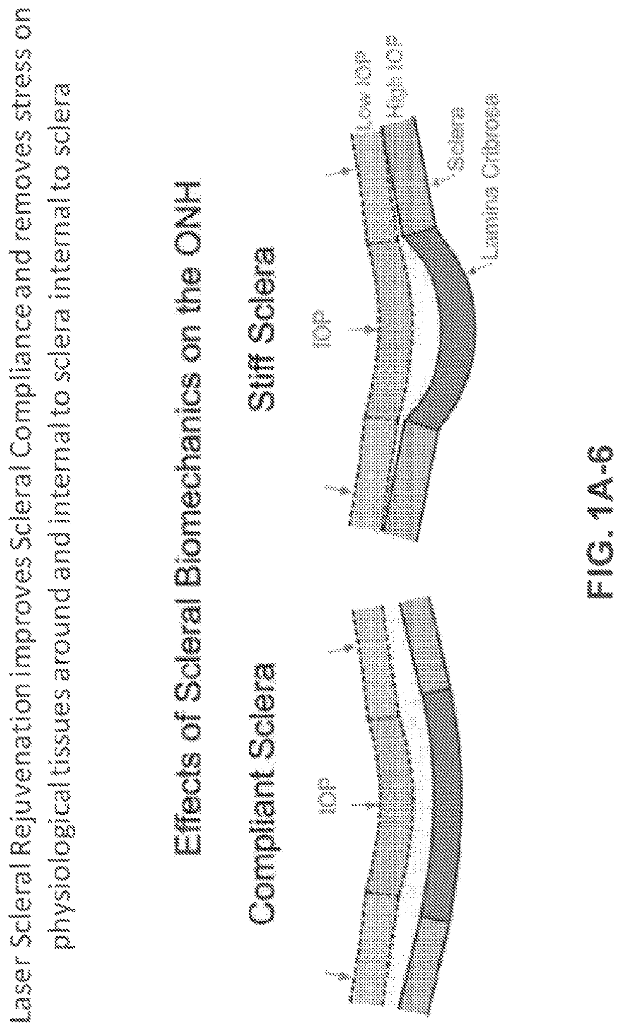 Systems and methods for ocular laser surgery and therapeutic treatments
