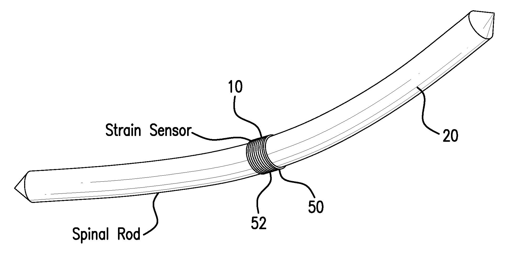Strain monitoring system and apparatus