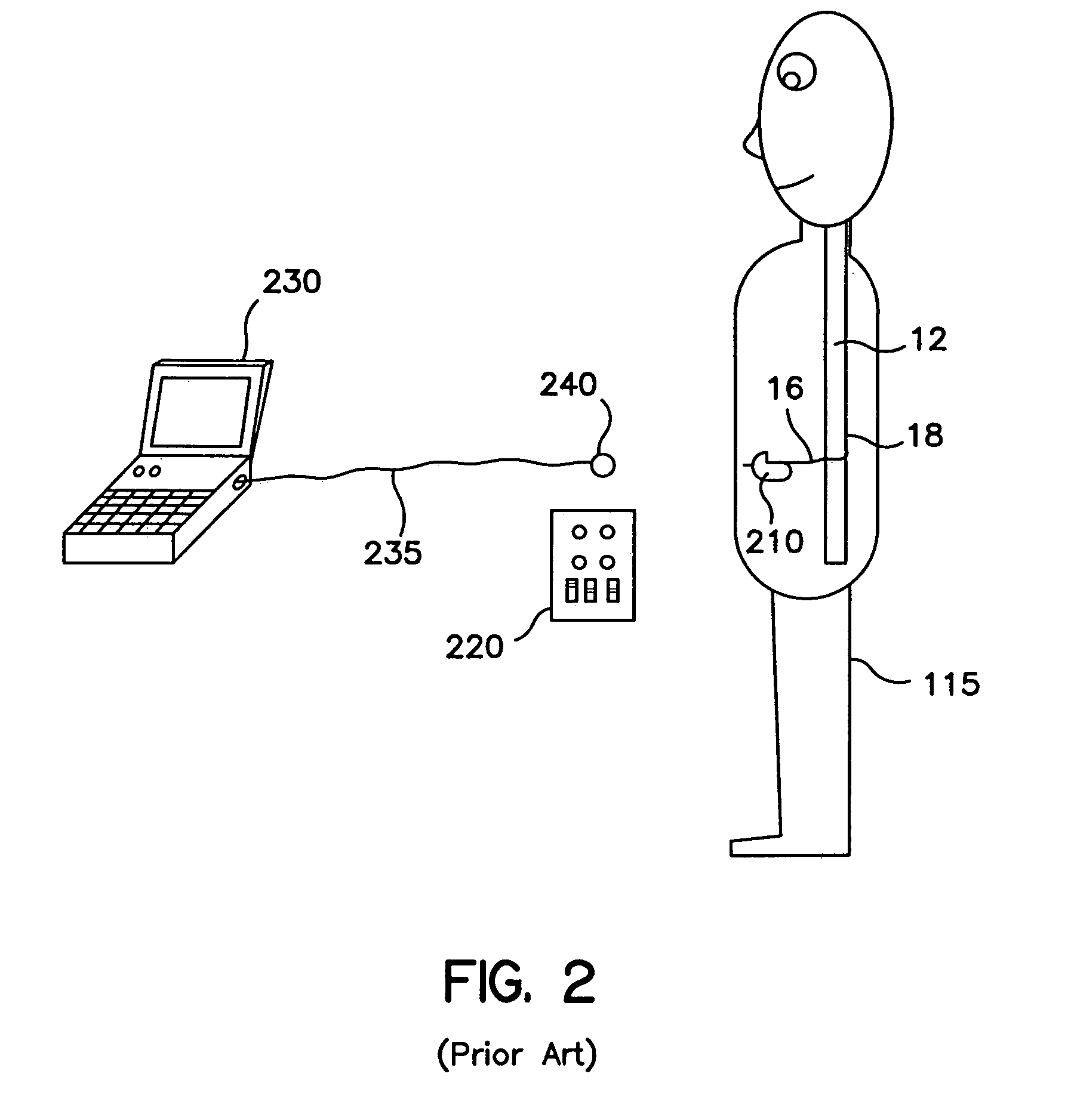 Method and apparatus for programming an implantable medical device