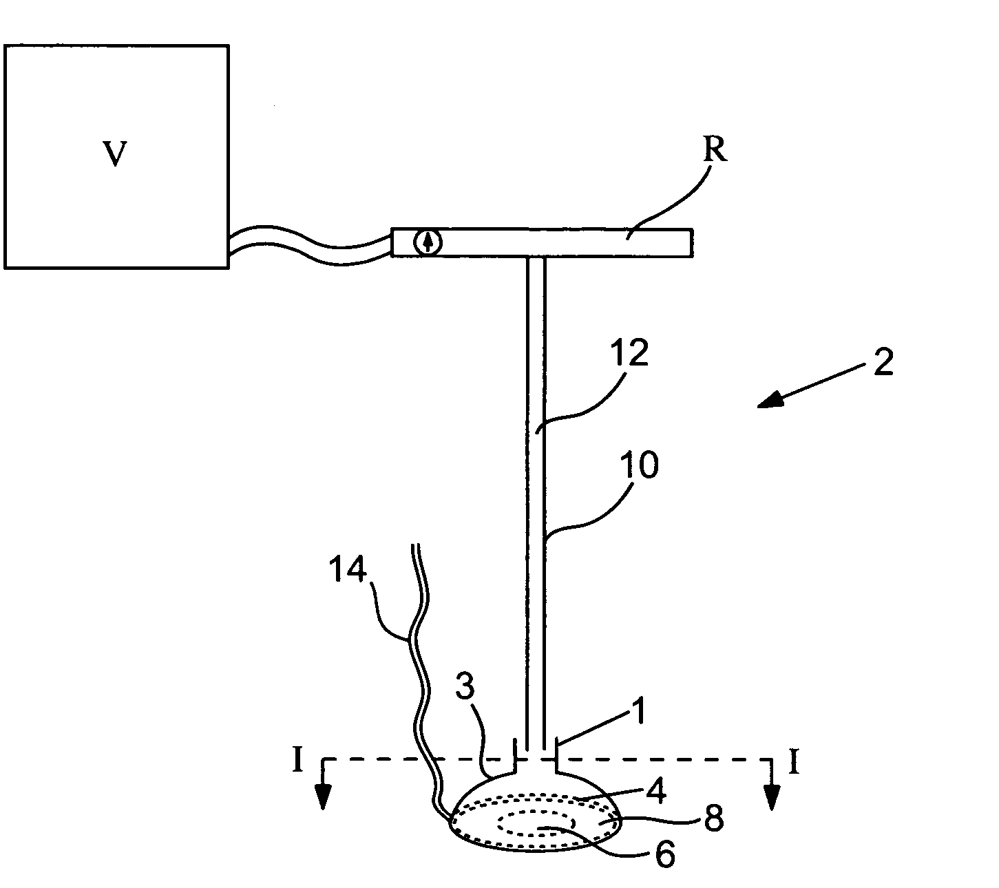 Organ manipulator and positioner and methods of using the same