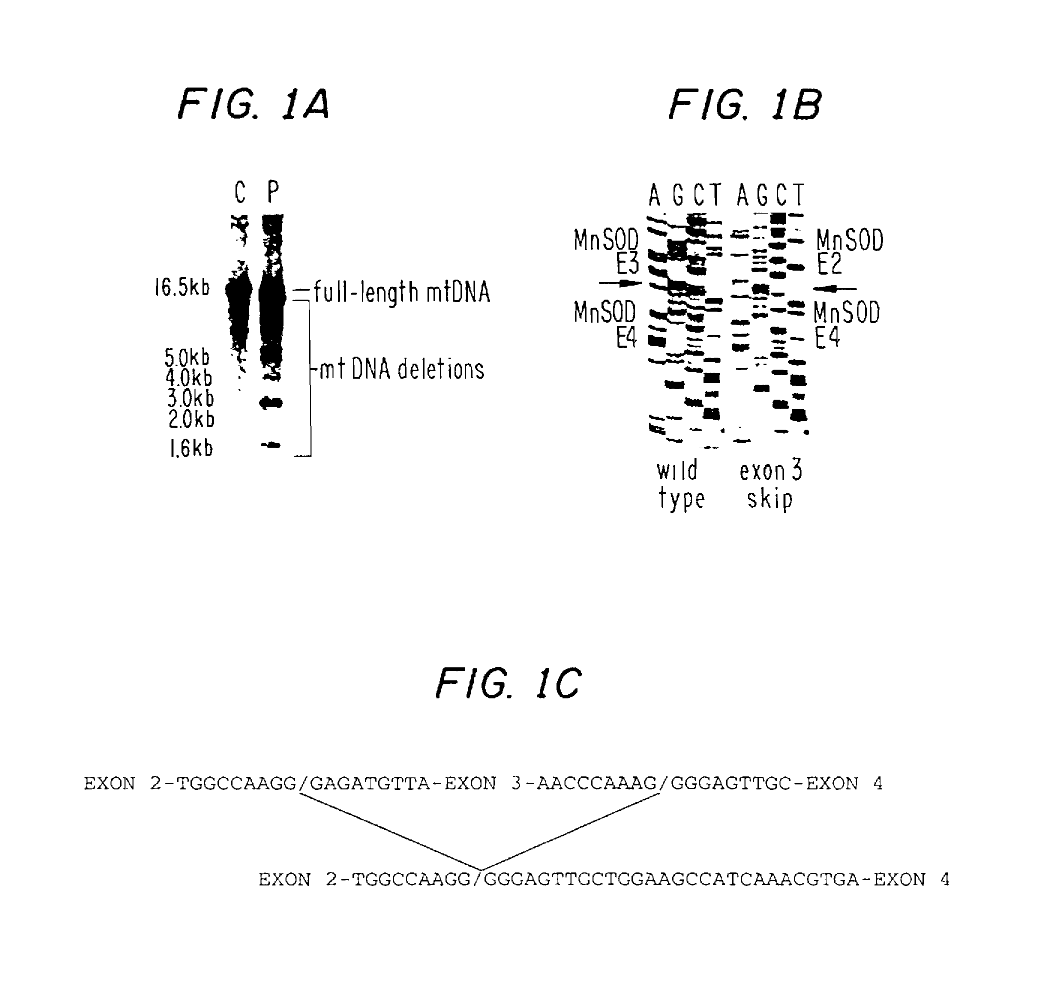 Manganese superoxide dismutase exon 3-deleted isoforms and nucleic acid molecules encoding the isoforms