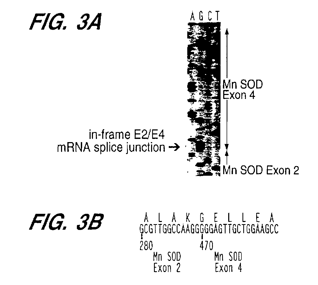 Manganese superoxide dismutase exon 3-deleted isoforms and nucleic acid molecules encoding the isoforms