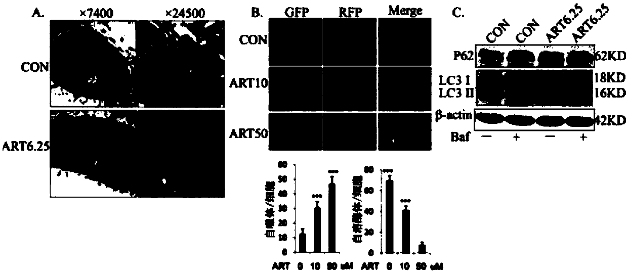 Application of artesunate in preparation of drug for inhibiting tumor cell drug resistance