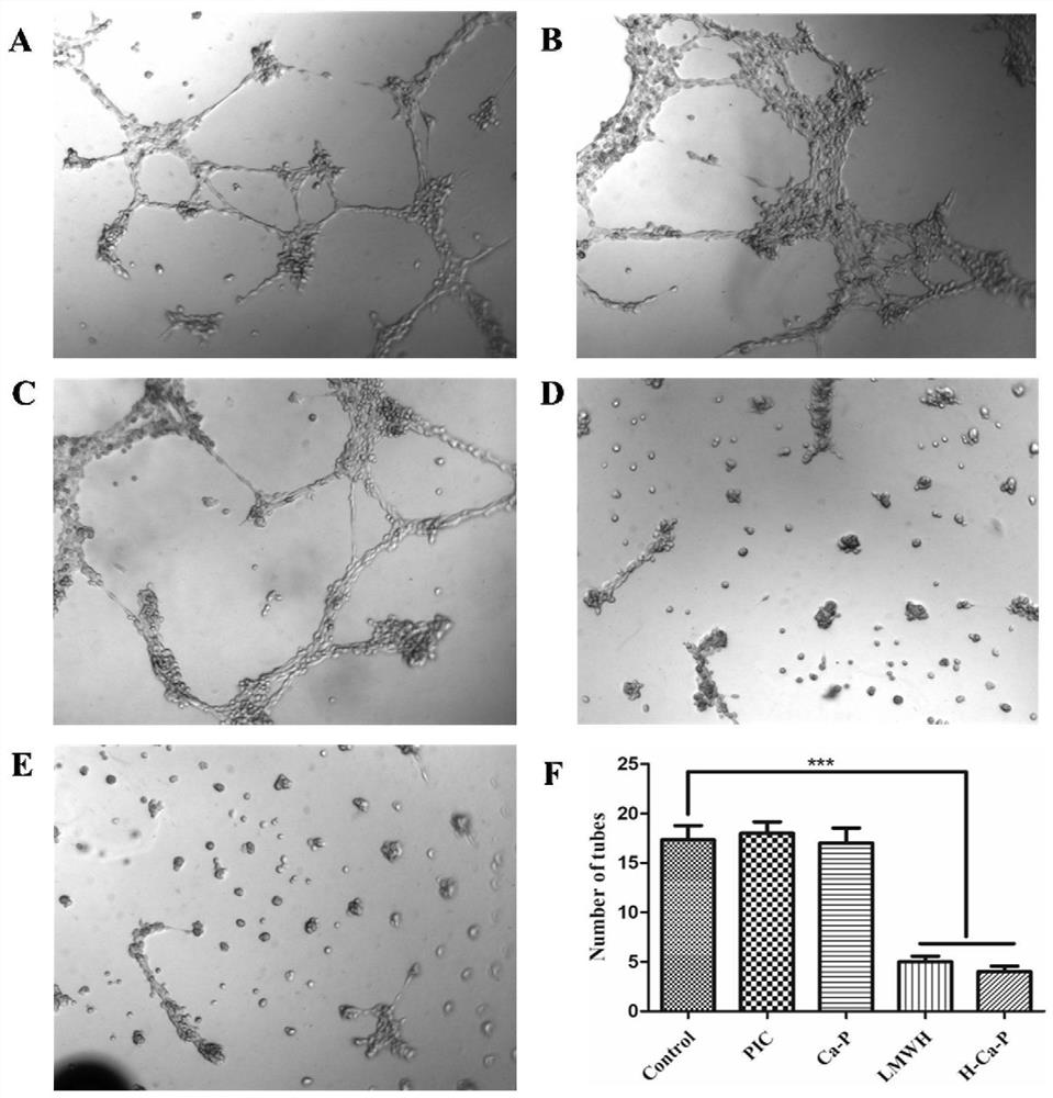 Calcium phosphate-lipid nano-drug co-delivery system composed of low molecular weight heparin and natural drug prodrug