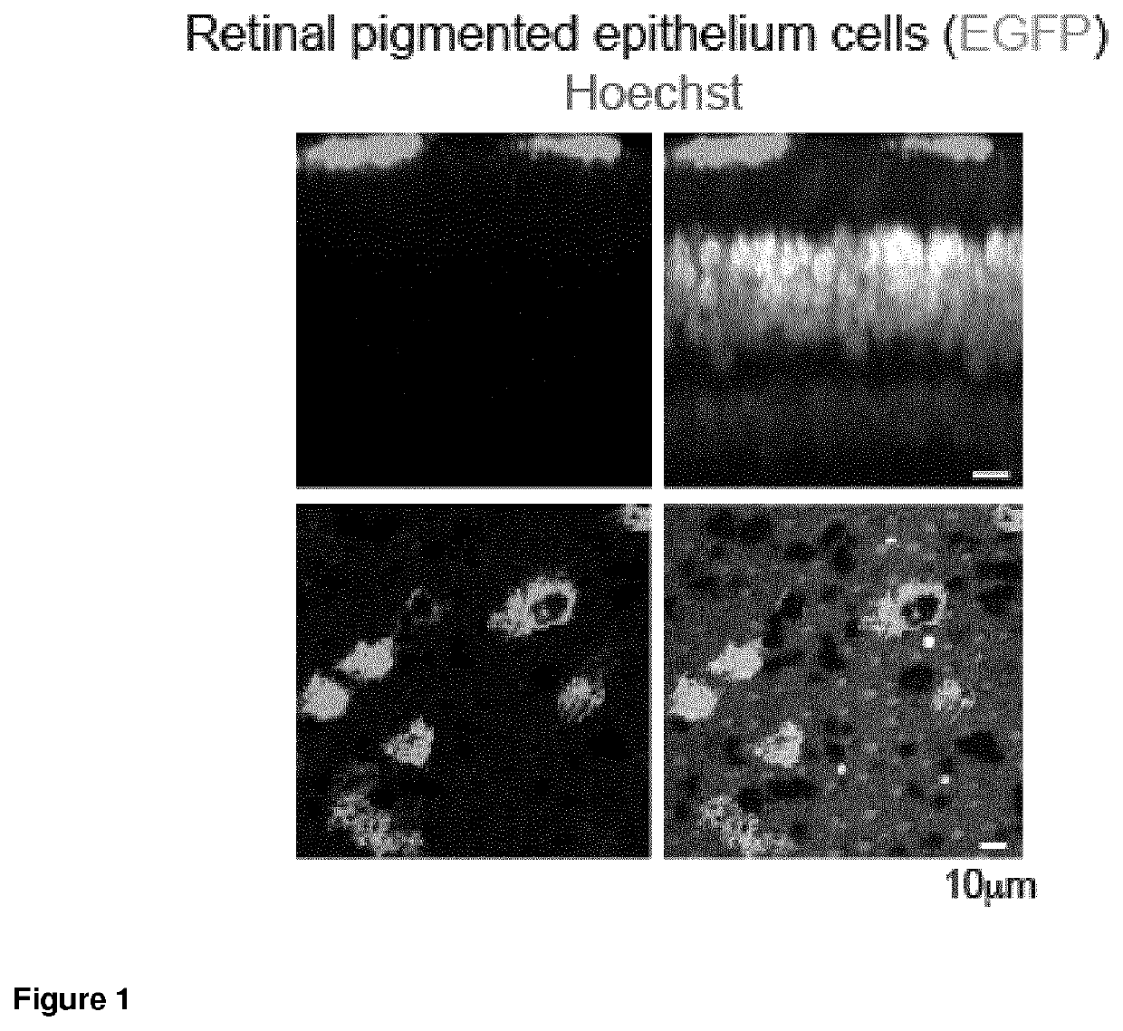 Synpiii, a promoter for the specific expression of genes in retinal pigment epithelium