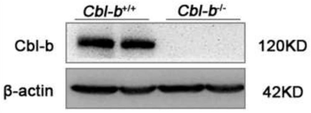 Application of Cbl-b protein in preparation of product with protective effect on lung injury induced by tobacco smoke