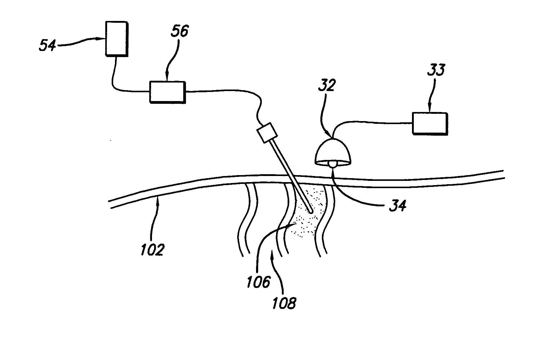 Apparatus and method for disrupting subcutaneous structures