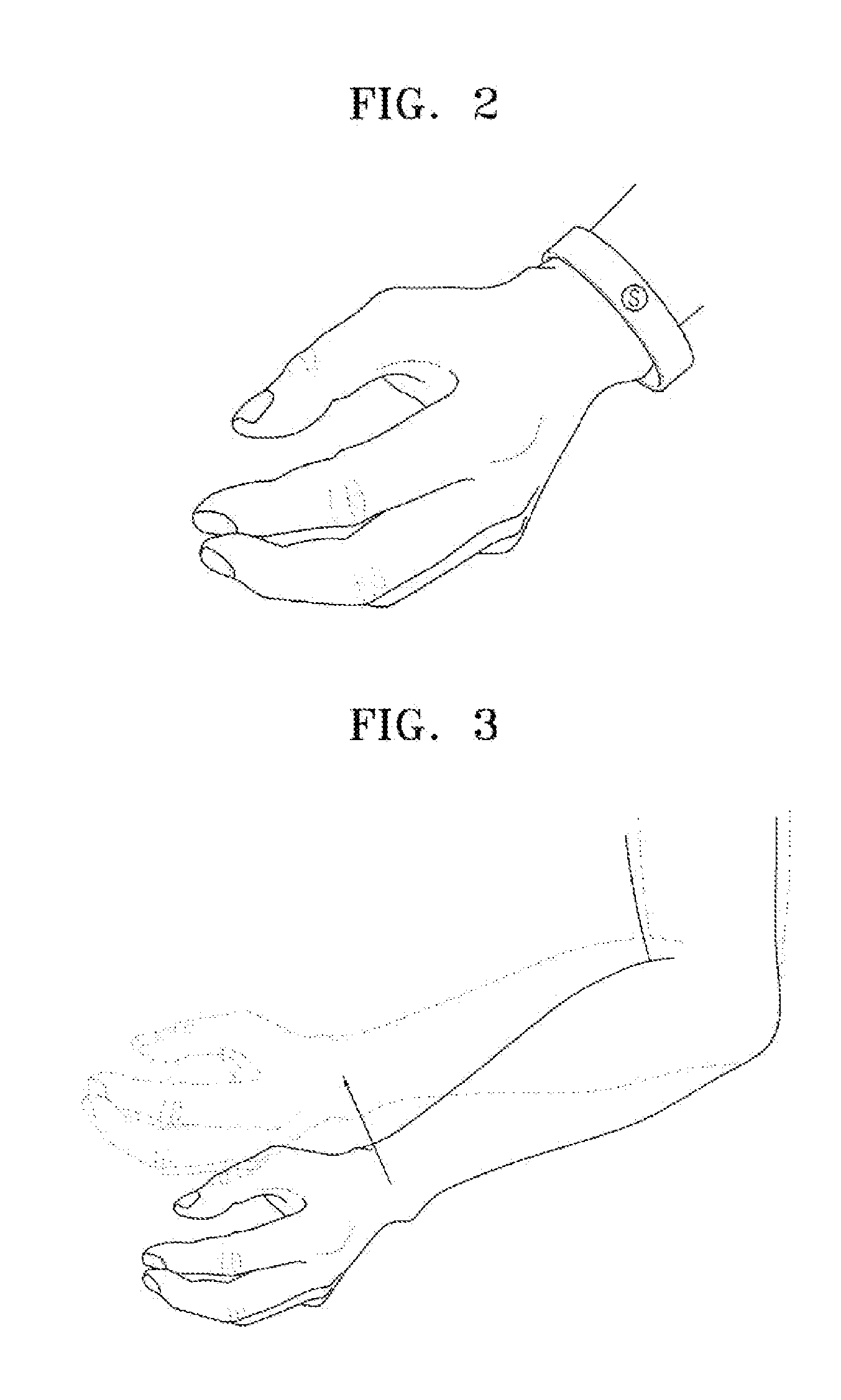 Apparatus for early detection of paralysis based on motion sensing