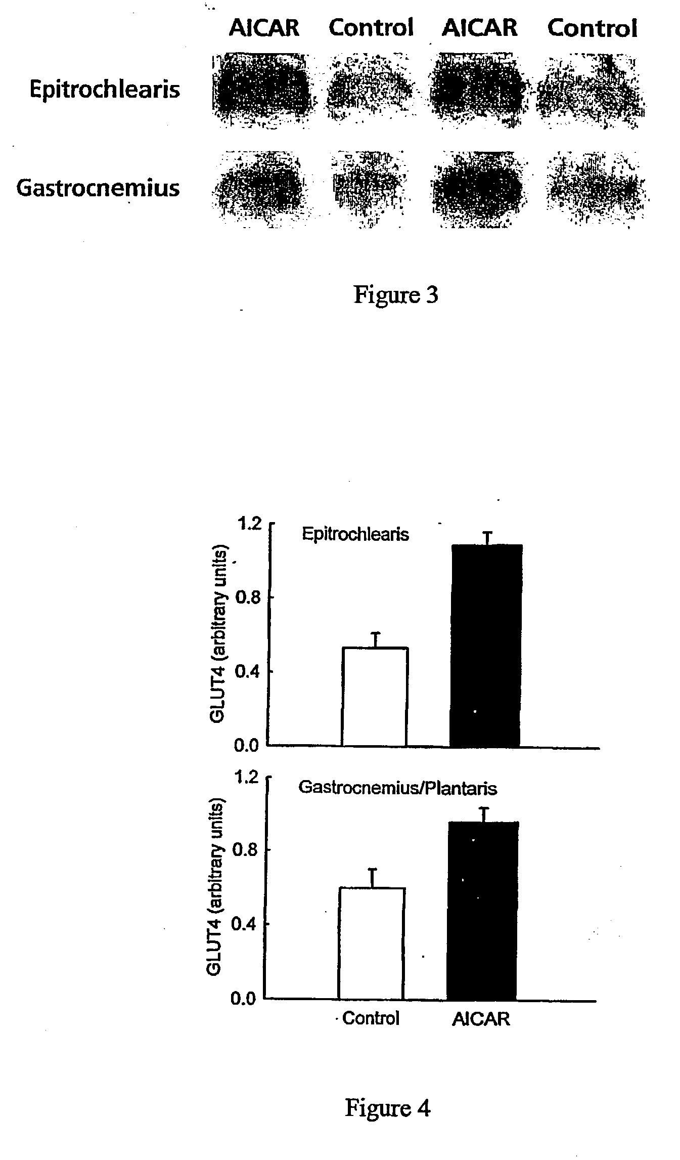 Use of amp kinase activators for treatment type 2 diabetes and insulin resistance