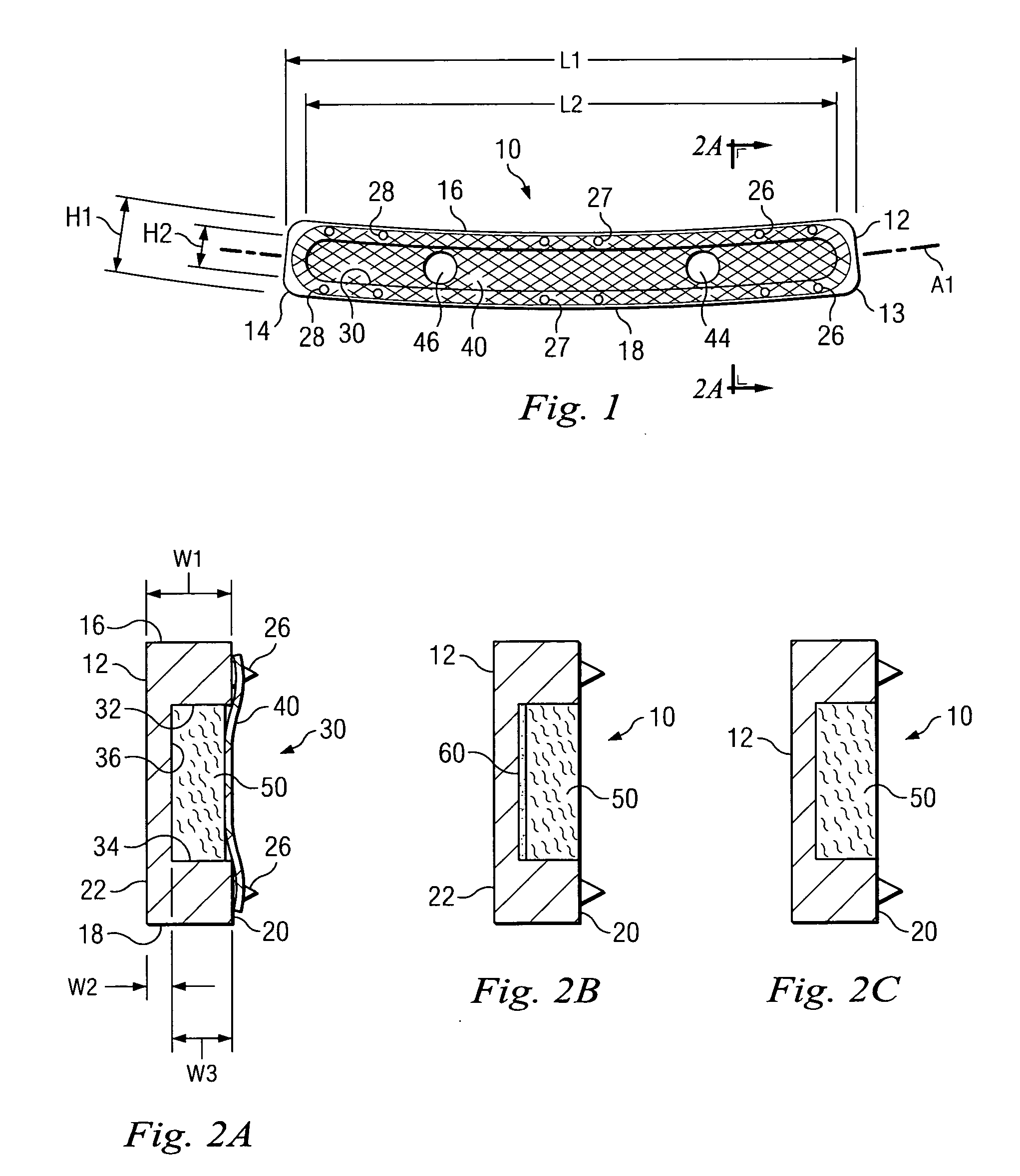 Fixation plate and method of use
