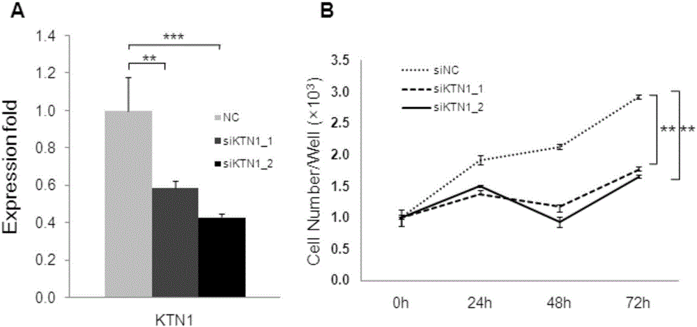 Medicine targeting KTN1 to treat skin squamous cell carcinoma