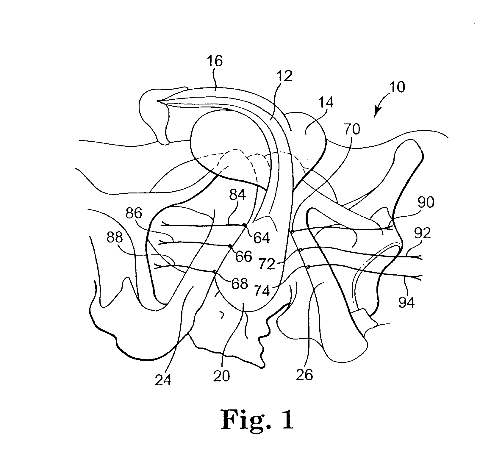 Methods and Apparatus for Securing and Tensioning a Urethral Sling to Pubic Bone