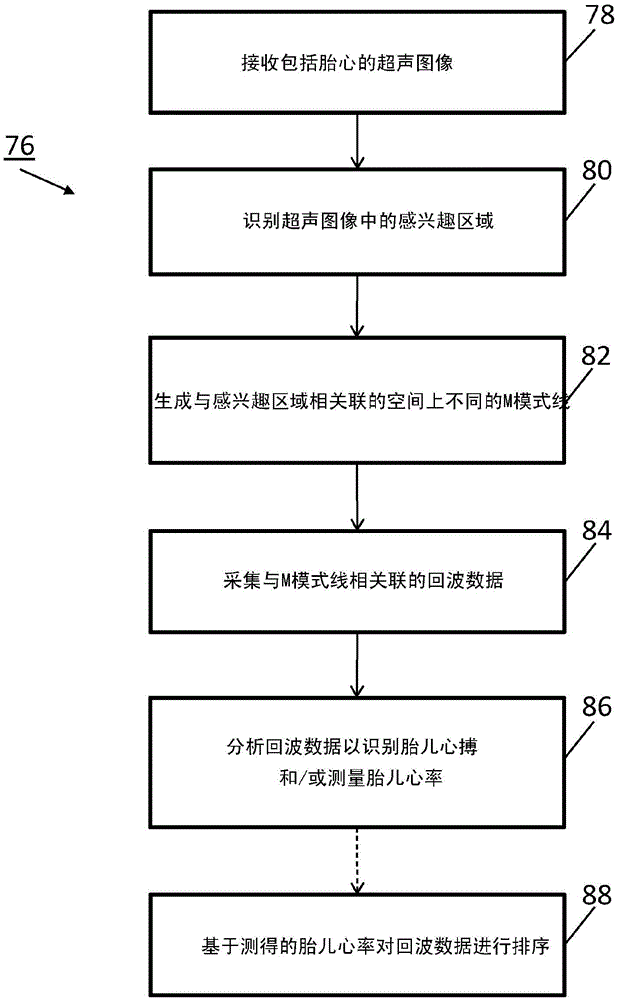 Ultrasound systems and methods for automated fetal heartbeat identification
