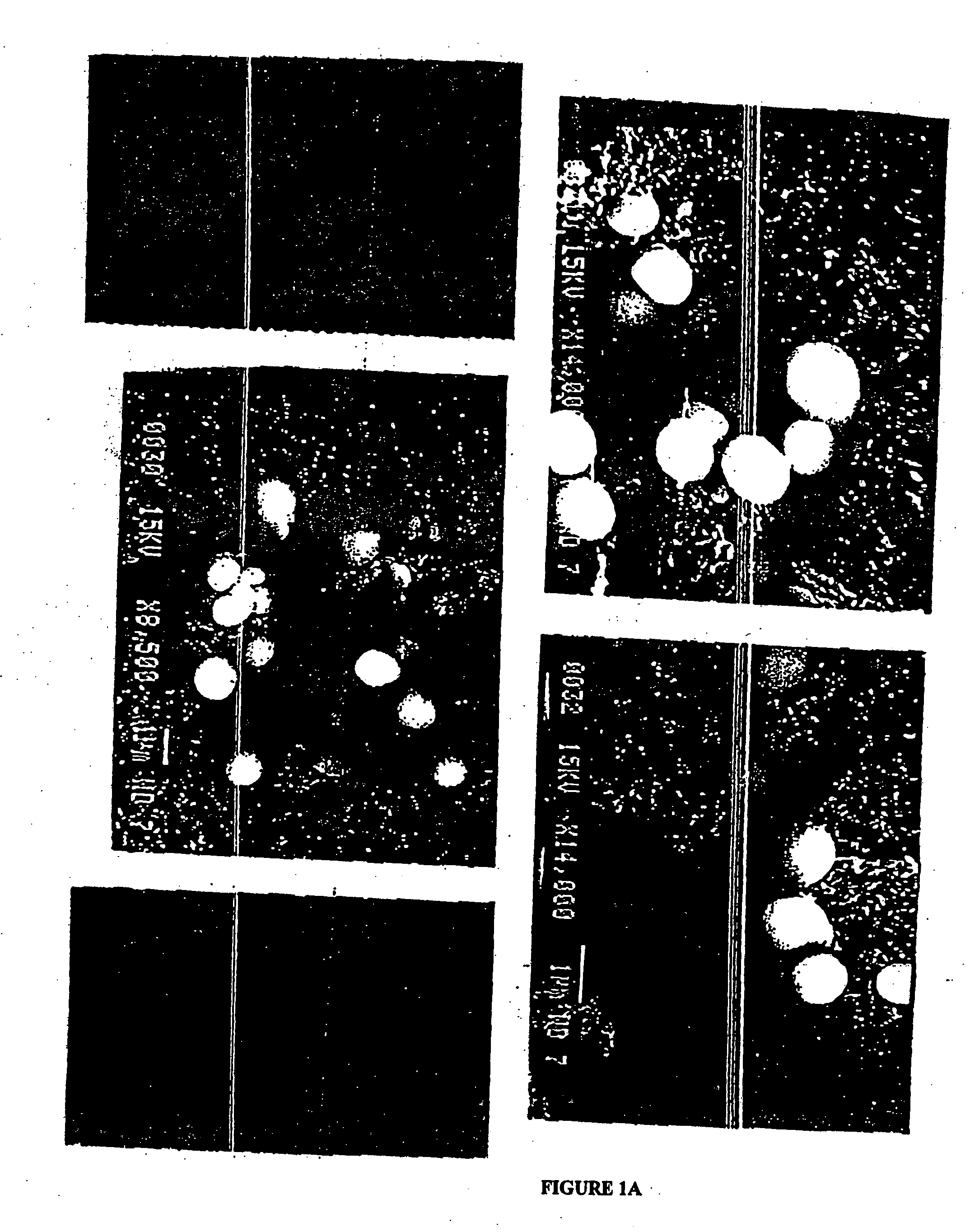 Therapeutic calcium phosphate particles and methods of manufacture and use