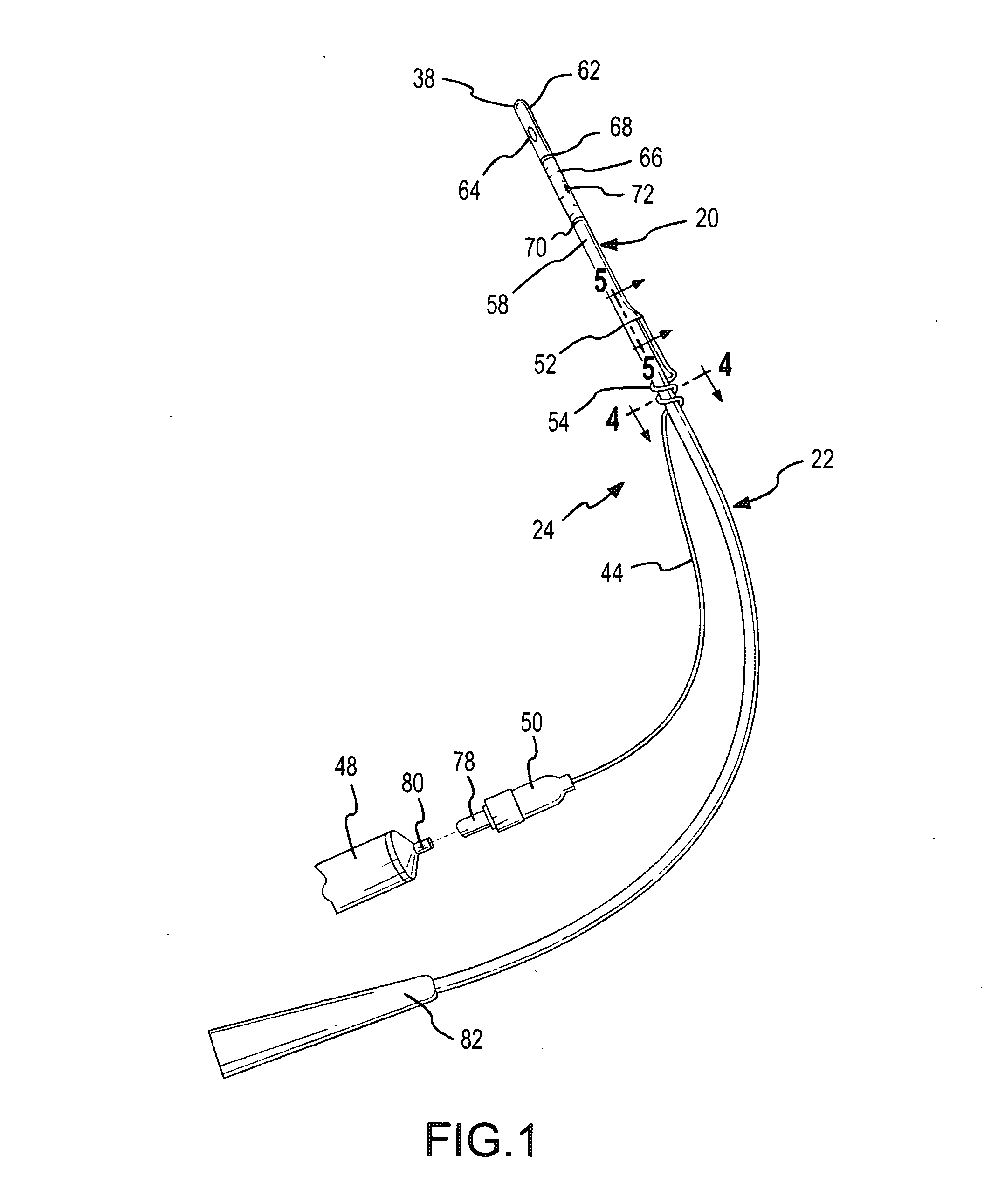 Urinary catheter and method with increased resistance to obstructions