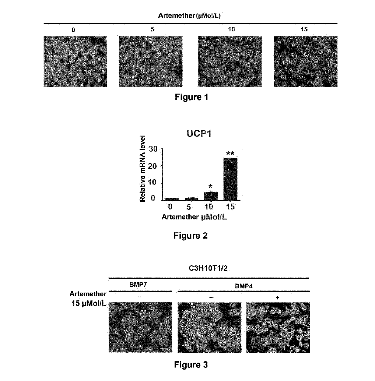Artemisinin analog, and use, method, and composition for promoting lipid catabolism and improving sugar metabolism