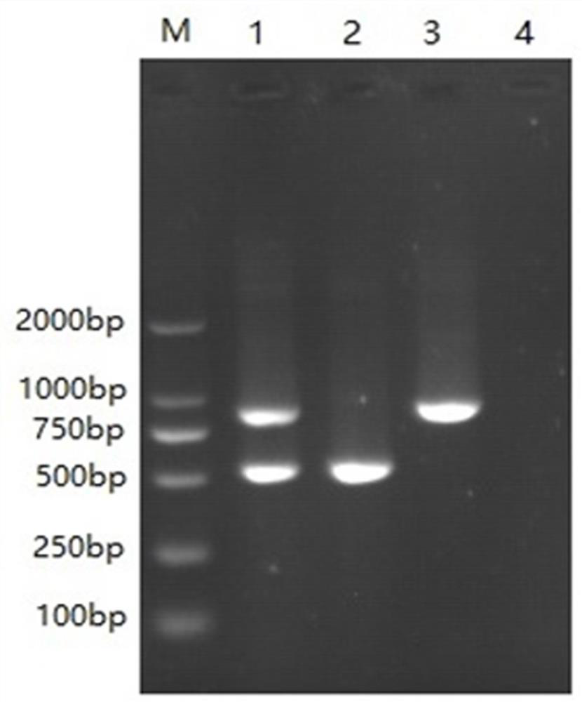 A primer set and dual RT-PCR method for the detection of bovine norovirus and bovine coronavirus