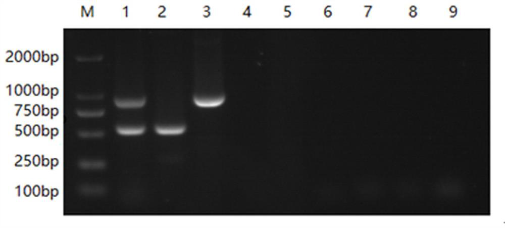A primer set and dual RT-PCR method for the detection of bovine norovirus and bovine coronavirus