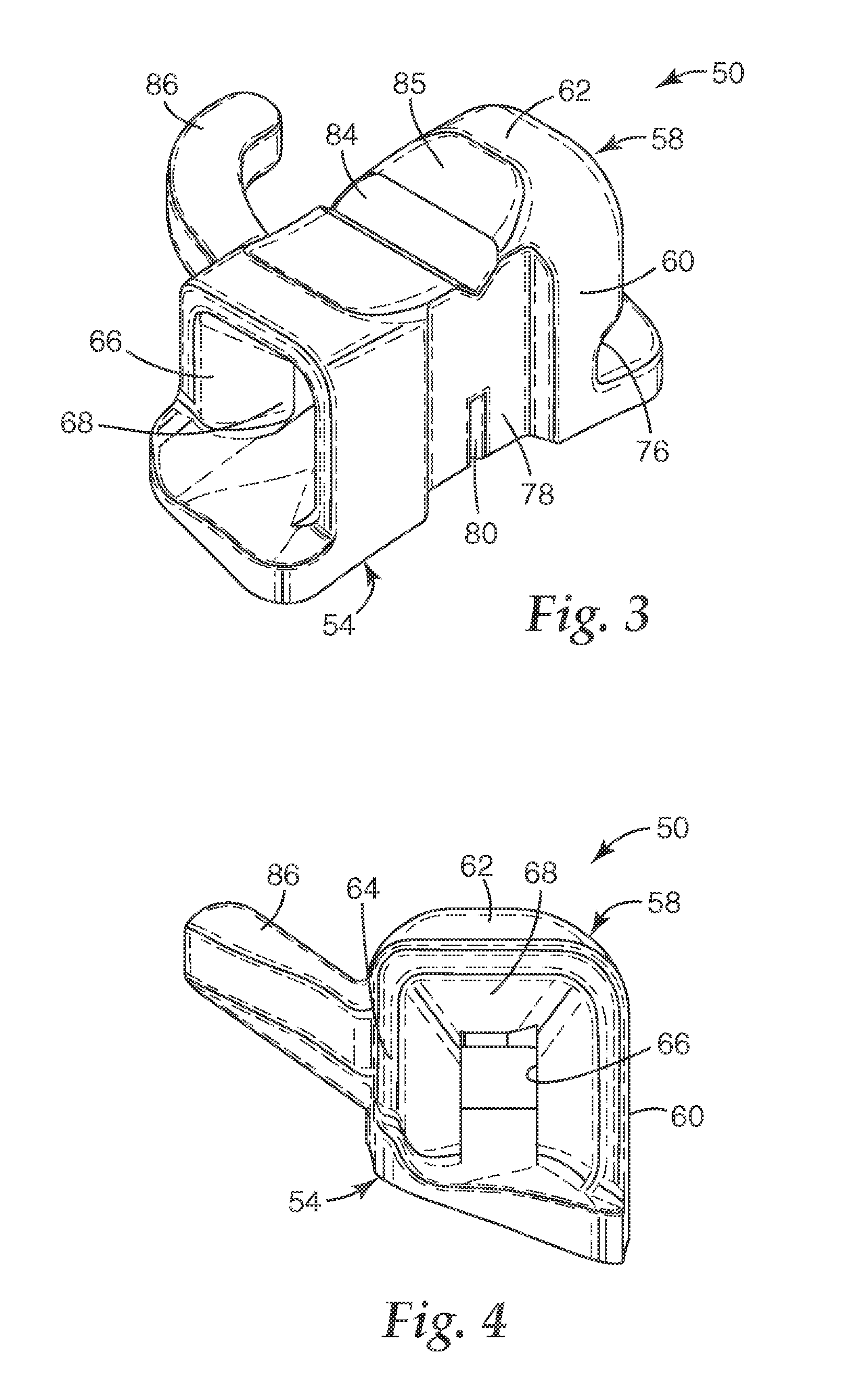 Molar appliance for an orthodontic brace