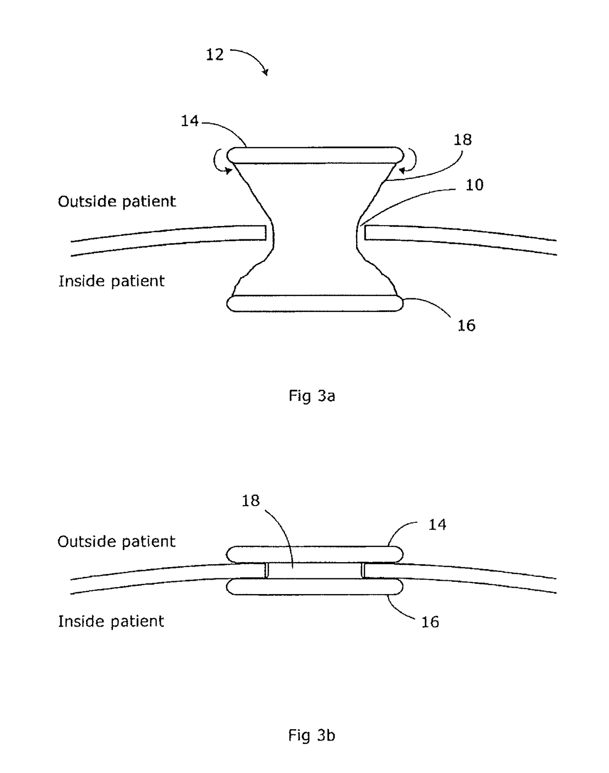 Surgical device